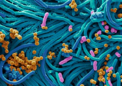 Professor Glenn Gibson: Current perspectives on gut health research: focus on prebiotics